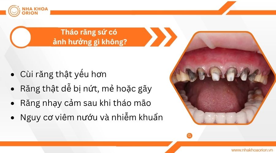 Th&aacute;o răng sứ c&oacute; ảnh hưởng g&igrave; kh&ocirc;ng