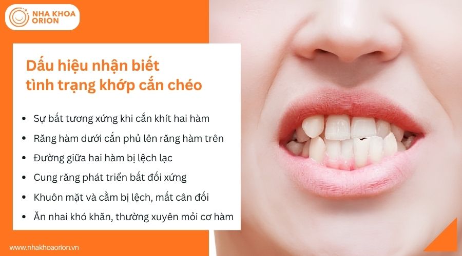 Dấu hiệu nhận biết t&igrave;nh trạng khớp cắn ch&eacute;o