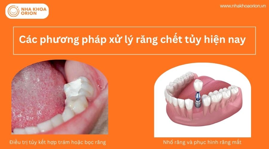 Nhổ răng v&agrave; phục h&igrave;nh răng mất