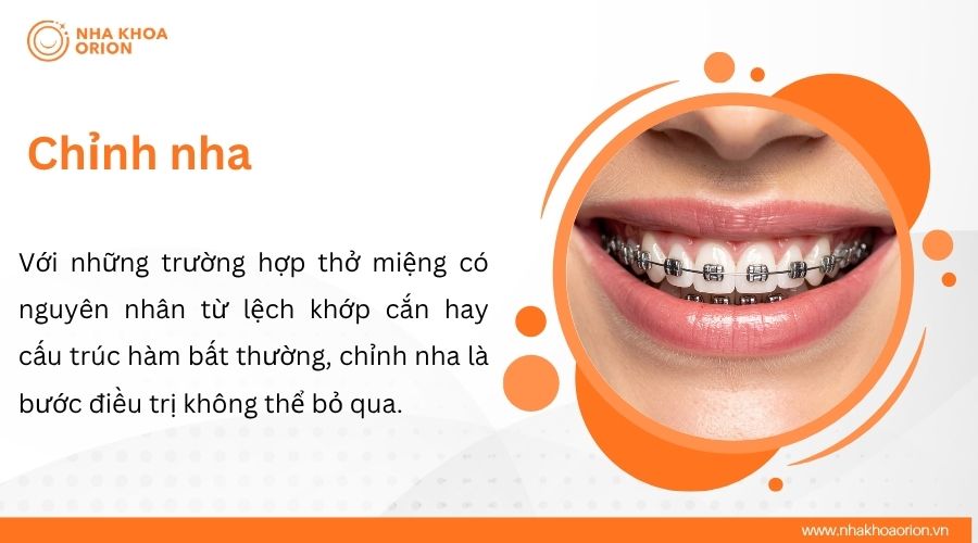 Chỉnh nha&nbsp;