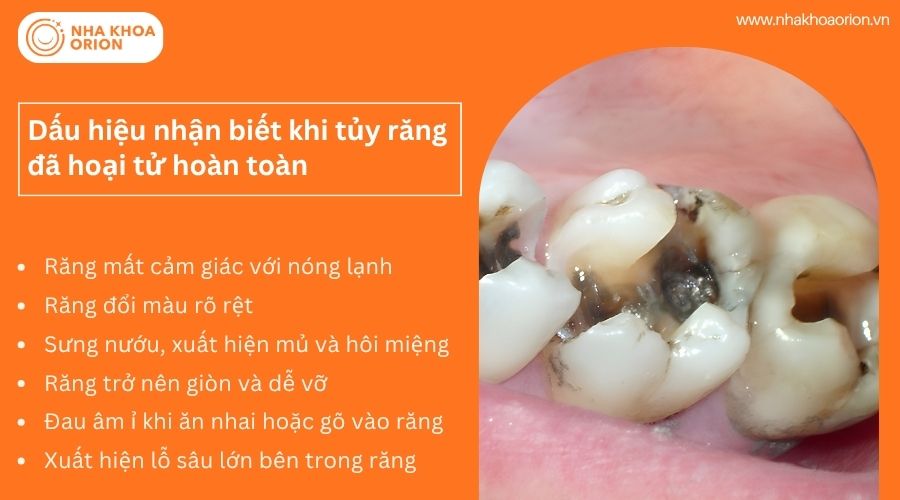 Dấu hiệu nhận biết khi tủy răng đ&atilde; hoại tử ho&agrave;n to&agrave;n