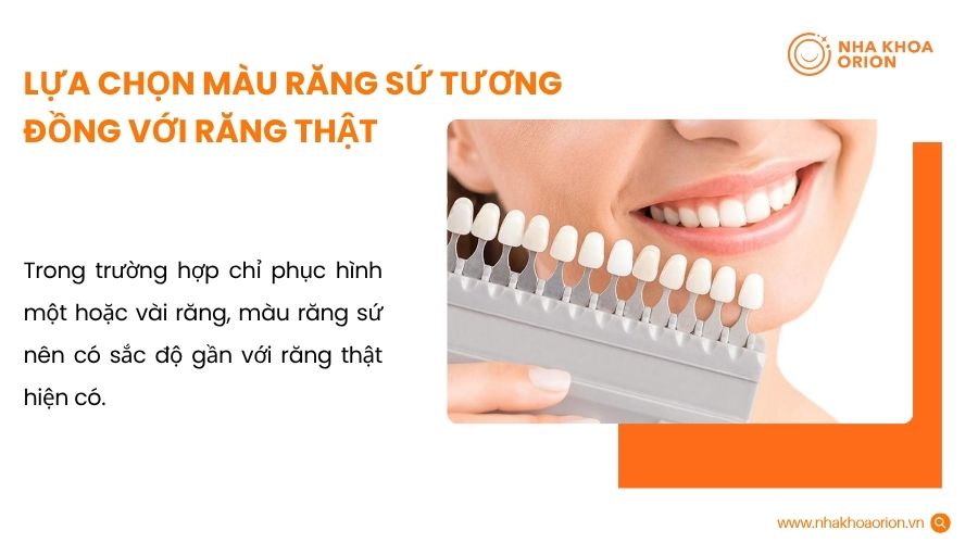 Lựa chọn m&agrave;u răng sứ tương đồng với răng thật