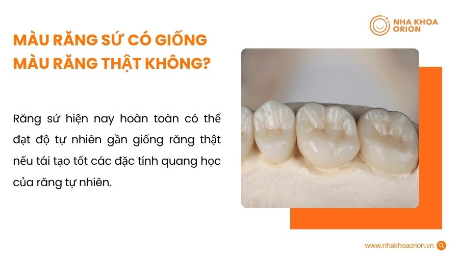 M&agrave;u răng sứ c&oacute; giống m&agrave;u răng thật kh&ocirc;ng