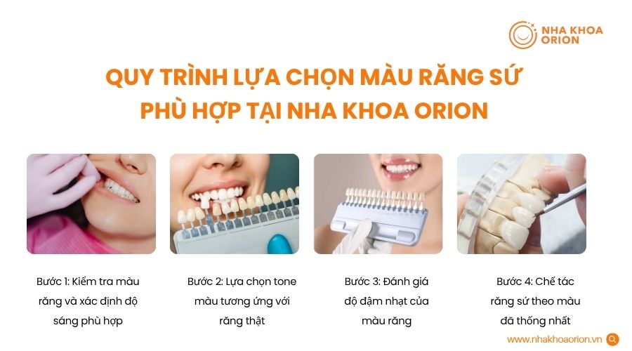Quy tr&igrave;nh lựa chọn m&agrave;u răng sứ ph&ugrave; hợp tại nha khoa Orion