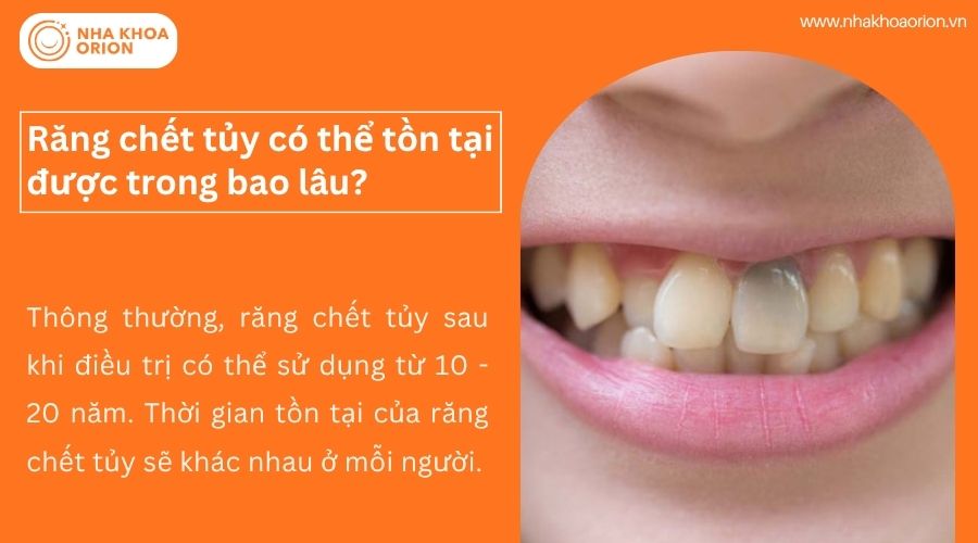 Răng chết tủy c&oacute; thể tồn tại được trong bao l&acirc;u?