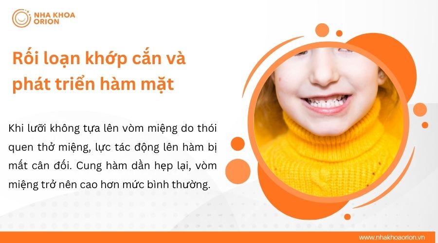 Rối loạn khớp cắn v&agrave; ph&aacute;t triển h&agrave;m mặt