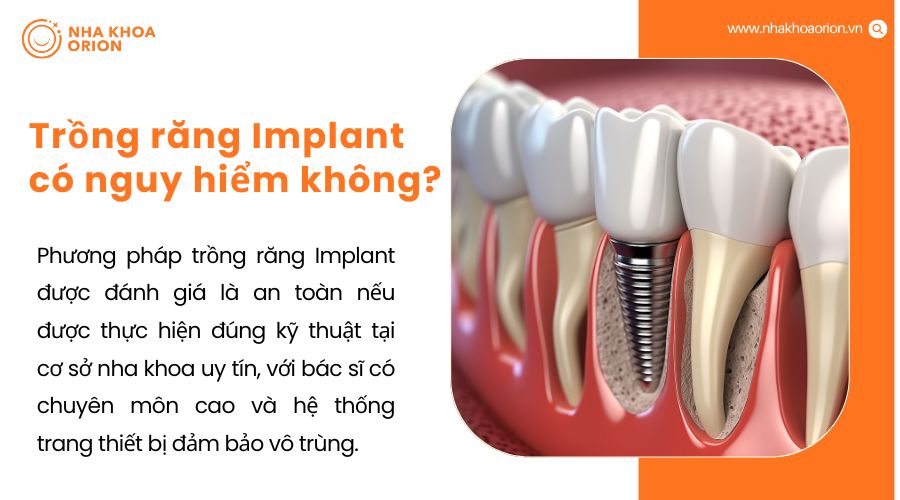 Trồng răng Implant c&oacute; nguy hiểm kh&ocirc;ng?
