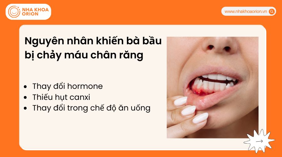 Nguy&ecirc;n nh&acirc;n khiến b&agrave; bầu bị chảy m&aacute;u ch&acirc;n răng