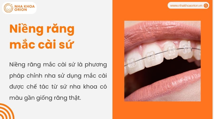 Niềng răng mắc c&agrave;i sứ