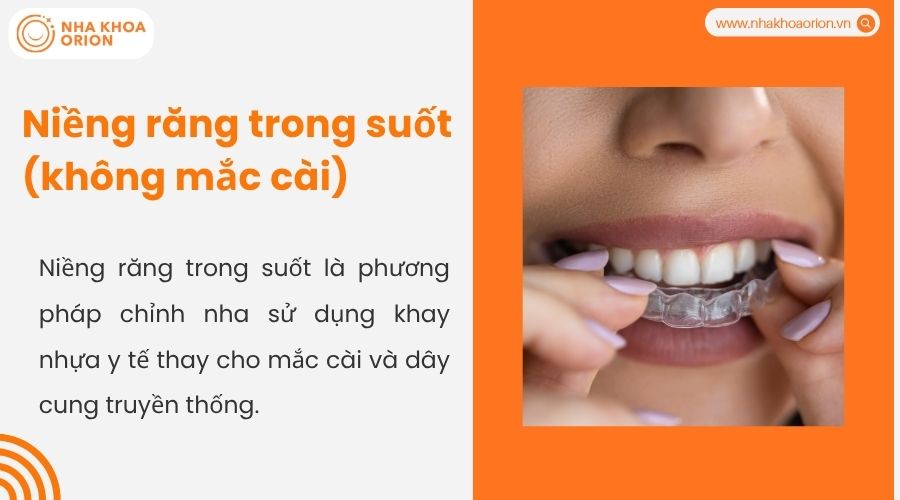 Niềng răng trong suốt