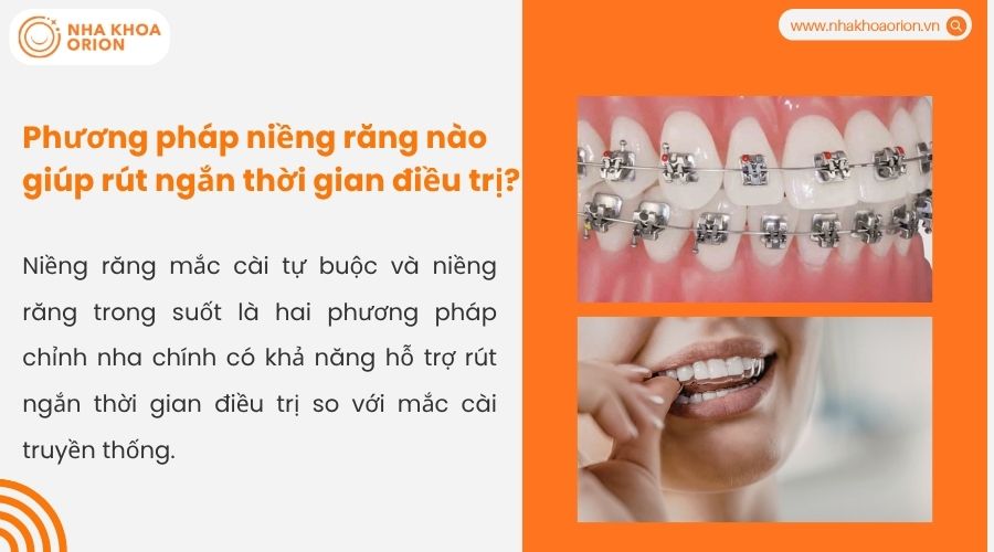 Phương ph&aacute;p niềng răng n&agrave;o gi&uacute;p r&uacute;t ngắn thời gian điều trị?