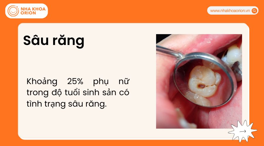 S&acirc;u răng