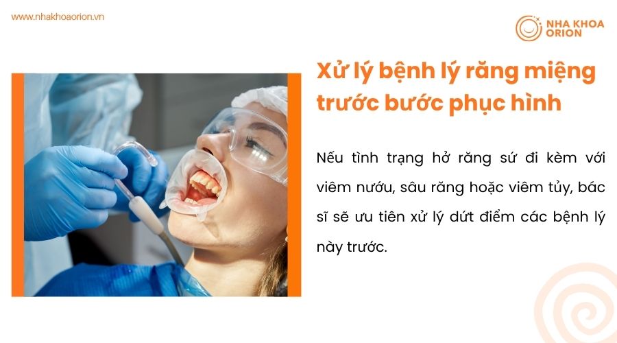 Xử lý bệnh lý răng miệng trước bước phục hình