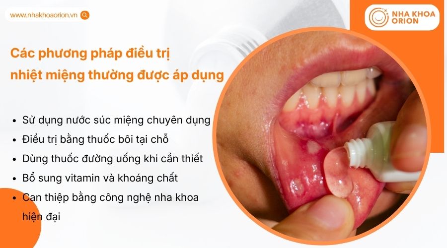 Các cách trị nhiệt miệng thường được áp dụng