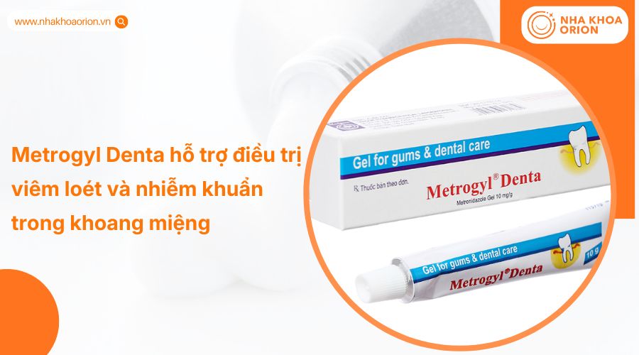 Thuốc bôi nhiệt miệng Metrogyl Denta