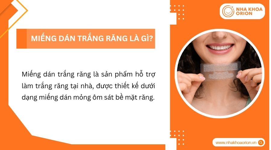 Miếng dán trắng răng là gì