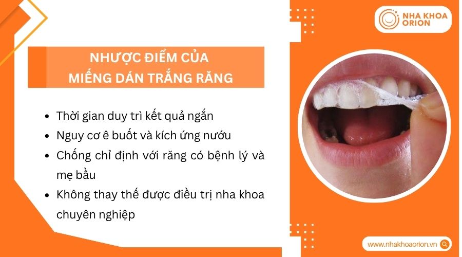 Nhược điểm của miếng dán trắng răng