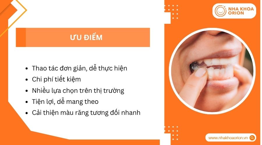 Ưu điểm của miếng dán trắng răng