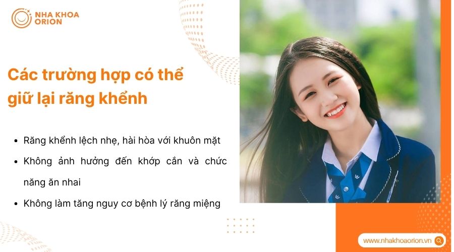 Răng khểnh c&oacute; thể giữ nếu kh&ocirc;ng ảnh hưởng thẩm mỹ, chức năng v&agrave; sức khỏe