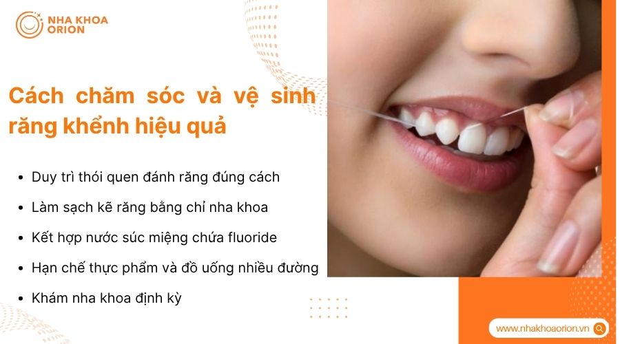 Chăm s&oacute;c đ&uacute;ng c&aacute;ch gi&uacute;p hạn chế nguy cơ s&acirc;u răng v&agrave; vi&ecirc;m nướu quanh răng khểnh