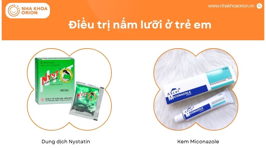 Điều trị nấm lưỡi ở trẻ nhỏ chủ yếu dùng thuốc kháng nấm an toàn theo chỉ định bác sĩ