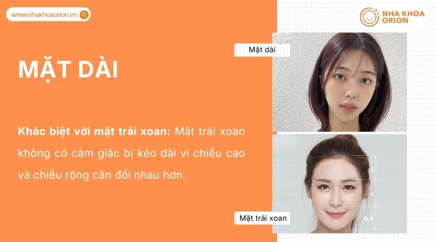 Khu&ocirc;n mặt d&agrave;i c&oacute; chiều cao vượt trội so với chiều rộng, tạo đường n&eacute;t thon đặc trưng