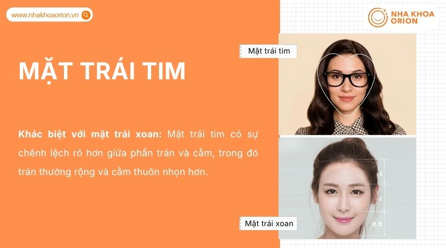 Tr&aacute;n rộng thu hẹp dần xuống cằm nhỏ, tạo h&igrave;nh d&aacute;ng tr&aacute;i tim đặc trưng