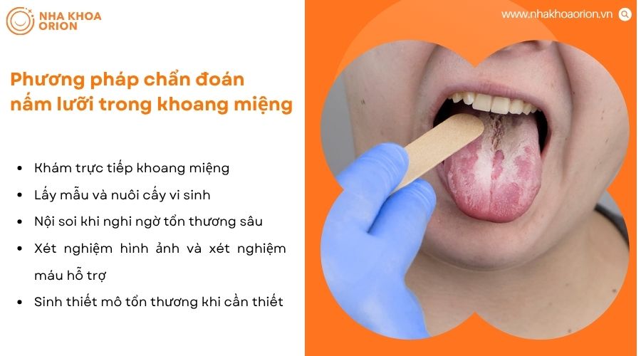 Phương pháp chẩn đoán nấm lưỡi gồm khám miệng và các xét nghiệm hỗ trợ khi cần thiết