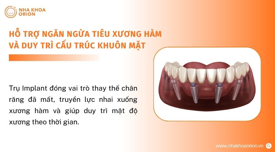 Cấy gh&eacute;p Implant gi&uacute;p hạn chế t&igrave;nh trạng ti&ecirc;u xương ổ răng sau mất răng