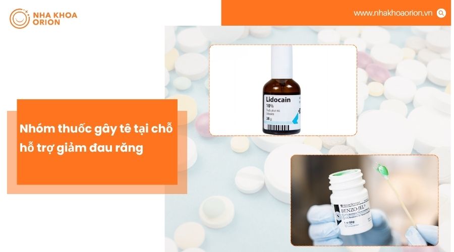 Nhóm thuốc gây tê tại chỗ giúp giảm đau răng nhanh bằng cách làm tê vùng bị đau