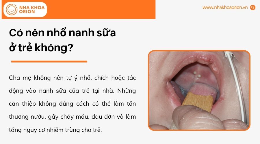 Nanh sữa chỉ được xử l&yacute; khi c&oacute; chỉ định từ b&aacute;c sĩ