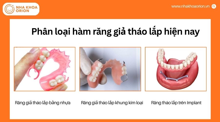 Ba loại h&agrave;m răng giả th&aacute;o lắp phổ biến hiện nay
