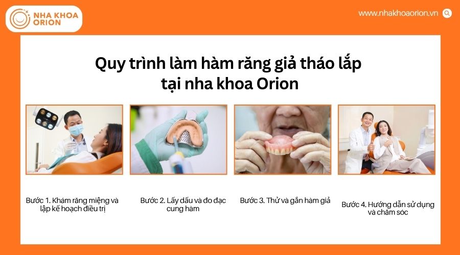Quy tr&igrave;nh l&agrave;m h&agrave;m răng giả th&aacute;o lắp được thực hiện b&agrave;i bản v&agrave; an to&agrave;n