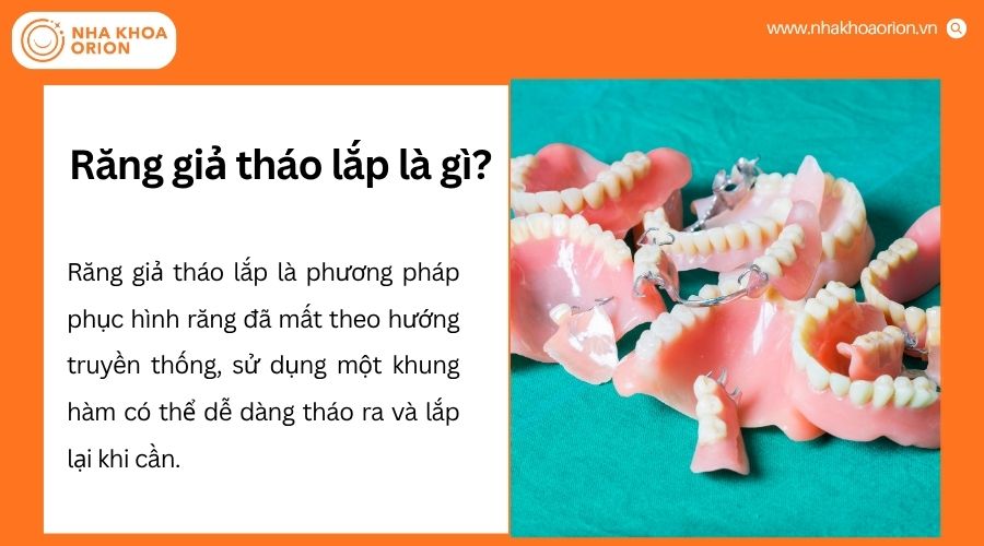 H&agrave;m răng giả th&aacute;o lắp gi&uacute;p phục hồi chức năng ăn nhai v&agrave; thẩm mỹ cho người mất răng