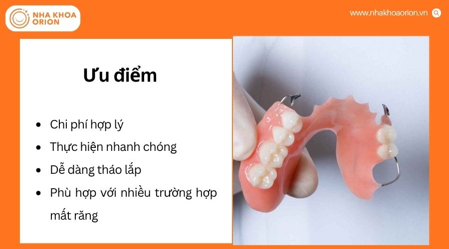 H&agrave;m răng giả th&aacute;o lắp c&oacute; chi ph&iacute; thấp, dễ sử dụng v&agrave; thực hiện nhanh ch&oacute;ng