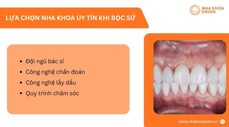 Chọn nha khoa uy tín giúp đảm bảo an toàn và hiệu quả thẩm mỹ lâu dài