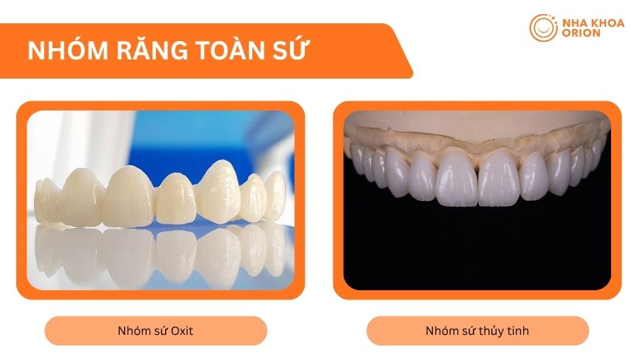 Răng toàn sứ gồm hai nhóm vật liệu chính với đặc tính và chỉ định phục hình khác nhau