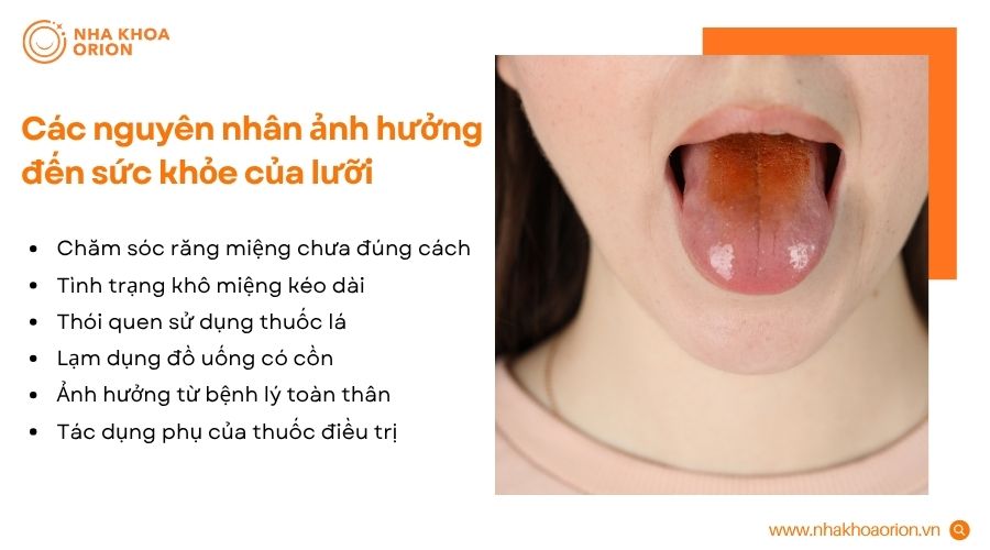 Th&oacute;i quen sinh hoạt kh&ocirc;ng l&agrave;nh mạnh v&agrave; bệnh l&yacute; c&oacute; thể l&agrave;m ảnh hưởng sức khỏe của lưỡi
