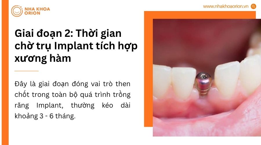 Giai đoạn 2 l&agrave; thời gian trụ Implant t&iacute;ch hợp với xương h&agrave;m trong 3-6 th&aacute;ng