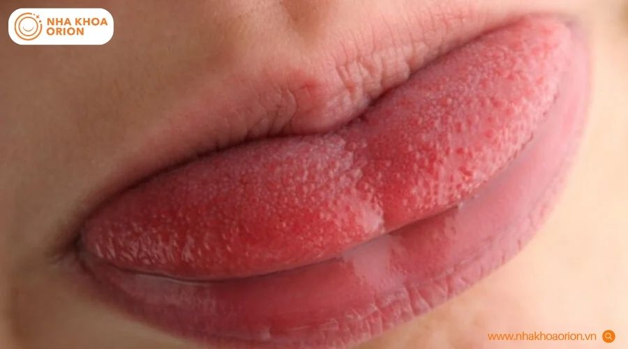 C&aacute;c đốm sậm m&agrave;u rải r&aacute;c l&agrave; dấu hiệu của t&igrave;nh trạng tăng sắc tố hoặc biến đổi nh&uacute; gai