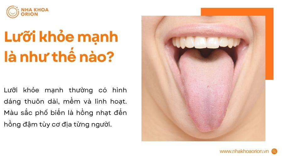 &nbsp;Lưỡi hồng nhạt, mềm mại, bề mặt ẩm v&agrave; kh&ocirc;ng tổn thương l&agrave; dấu hiệu b&igrave;nh thường