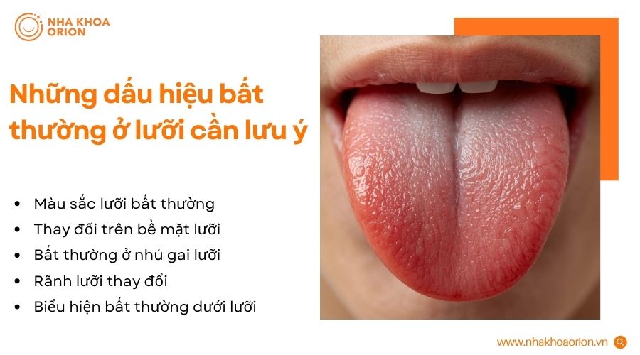 Lưỡi đổi m&agrave;u, bề mặt tổn thương hoặc xuất hiện bất thường cần được theo d&otilde;i v&agrave; kiểm tra