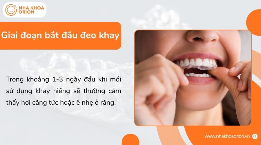 Giai đoạn đầu đeo khay c&oacute; thể g&acirc;y &ecirc; nhẹ do răng bắt đầu th&iacute;ch nghi lực dịch chuyển