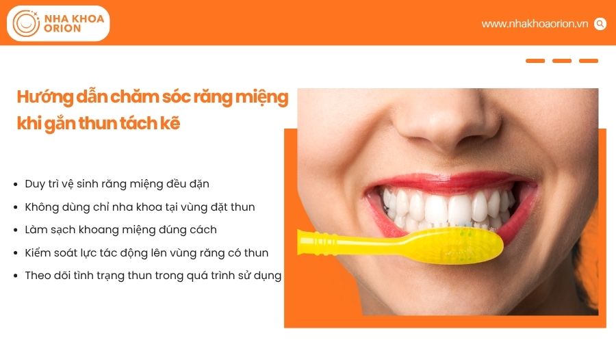 Chăm s&oacute;c răng miệng đ&uacute;ng c&aacute;ch khi đeo thun t&aacute;ch kẽ gi&uacute;p giảm &ecirc; buốt v&agrave; hạn chế thun rơi