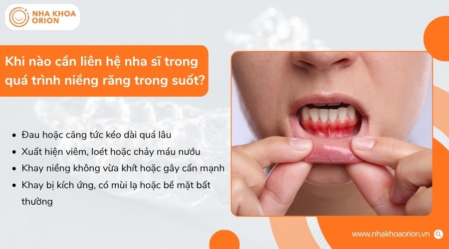 Cần li&ecirc;n hệ nha sĩ khi đau k&eacute;o d&agrave;i, nướu vi&ecirc;m, khay lệch hoặc c&oacute; dấu hiệu bất thường