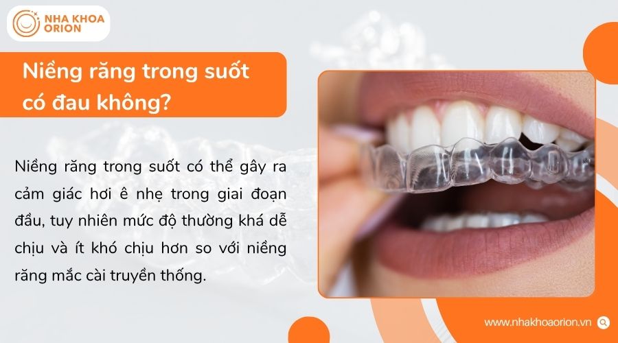 Niềng răng trong suốt c&oacute; thể g&acirc;y &ecirc; nhẹ v&agrave;i ng&agrave;y đầu khi răng th&iacute;ch nghi lực dịch chuyển