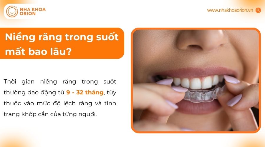 Thời gian niềng thường dao động từ 9 - 32 th&aacute;ng