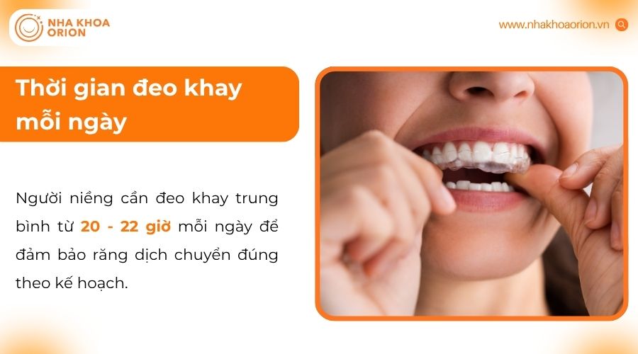 Đeo đủ 20-22 giờ mỗi ng&agrave;y gi&uacute;p đảm bảo răng di chuyển đ&uacute;ng kế hoạch