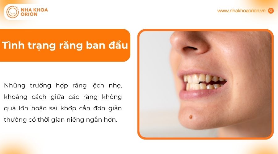 Mức độ lệch răng v&agrave; sức khỏe nền xương ảnh hưởng đến tốc độ dịch chuyển răng