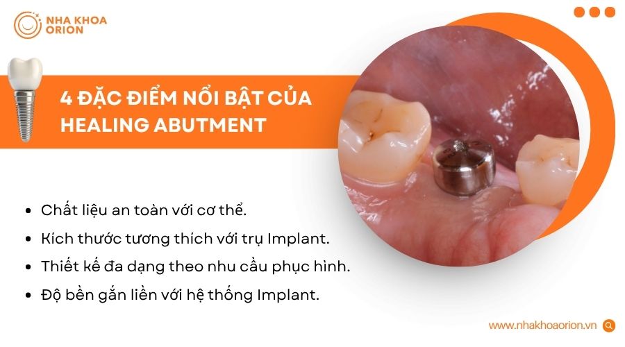 Healing Abutment đạt chuẩn cần đảm bảo chất liệu, k&iacute;ch thước, h&igrave;nh d&aacute;ng v&agrave; độ bền
